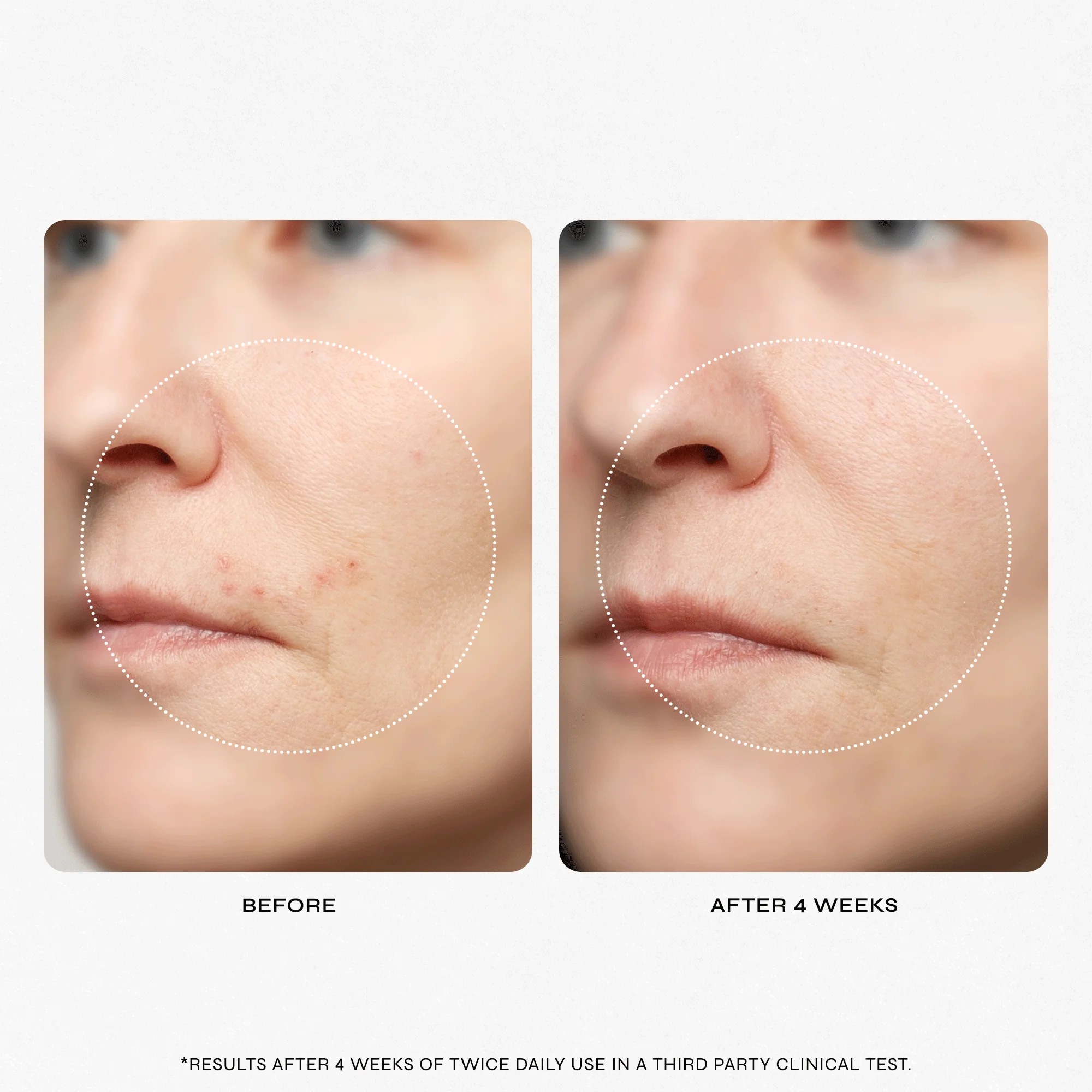 Clean Start Prep Step Facial Mist - Image 5